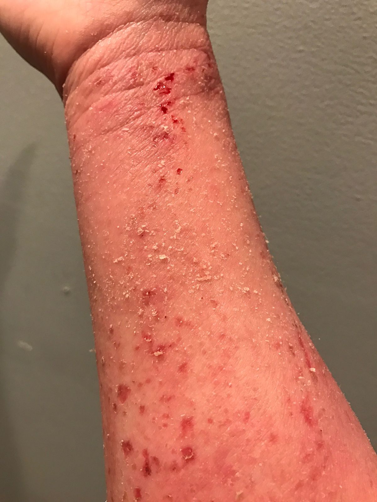 La imagen puede contener piel, mano, muñeca y brazo
