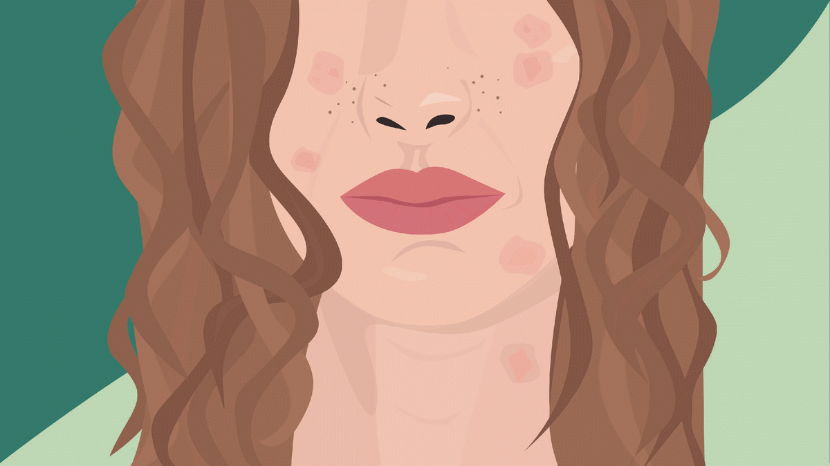 La imagen puede contener cara, cabeza, piel, boca y labios.